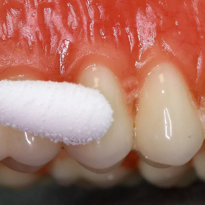 1280px-cold_test_with_ethyl_chloride