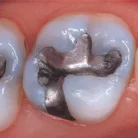 3-s2.0-b9780128137420000134-f13-02-9780128137420