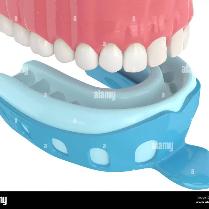 3d-render-of-upper-jaw-with-dental-impression-tray-over-white-background-2t1f0g1