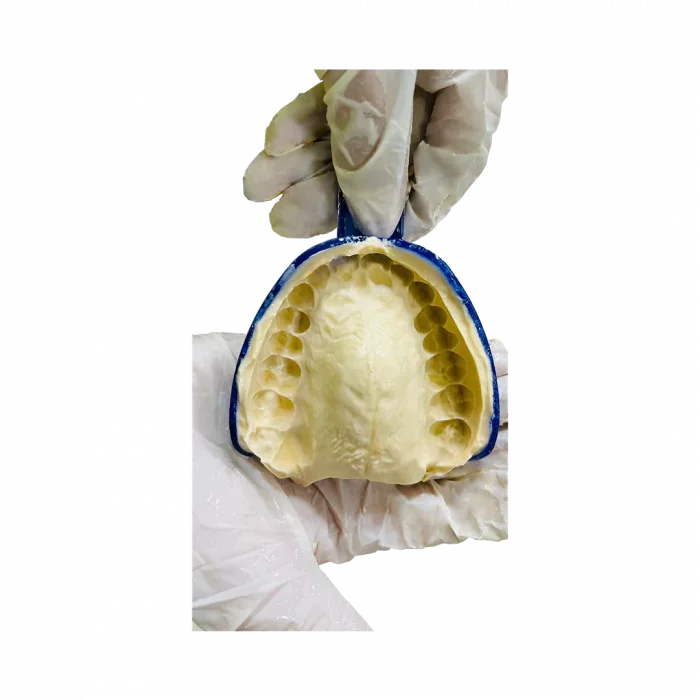Avue-Algin-Alginate-Detailed-Impression