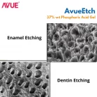 AvueEtch-37-Phosphoric-Acid-Gel