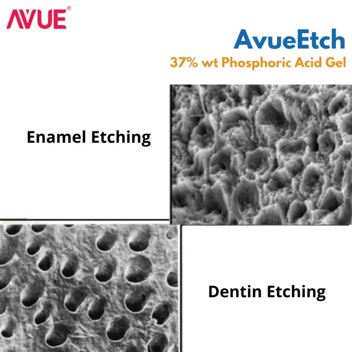 AvueEtch-37-Phosphoric-Acid-Gel AvueEtch-37-Phosphoric-Acid-Gel