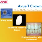 AvueTCrown-Bis-Acryl-Bridge-Self-Cure-Resin-Based-Material