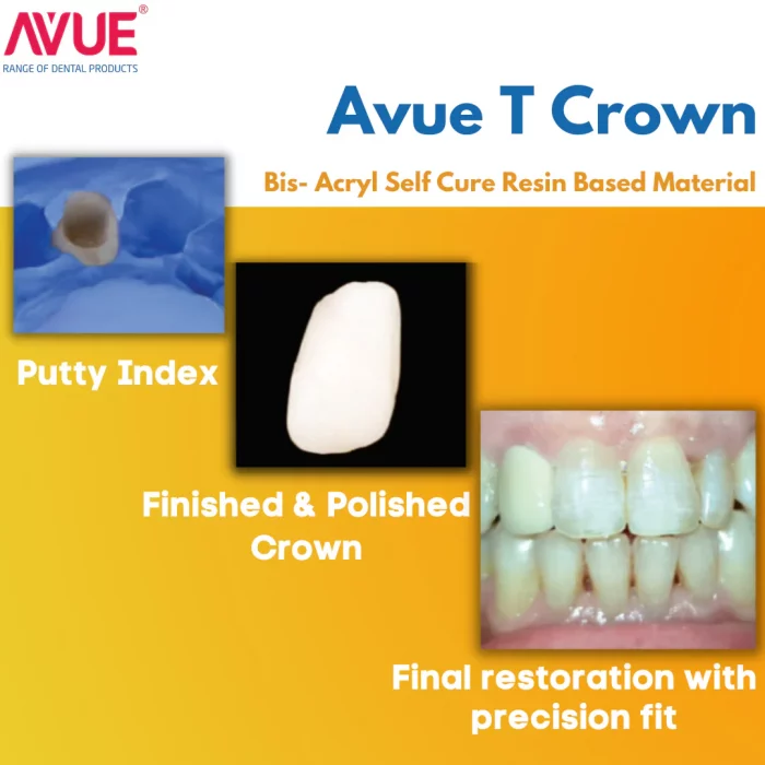 AvueTCrown-Bis-Acryl-Bridge-Self-Cure-Resin-Based-Material AvueTCrown-Bis-Acryl-Bridge-Self-Cure-Resin-Based-Material