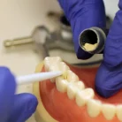 biodentine-placement-1024x614