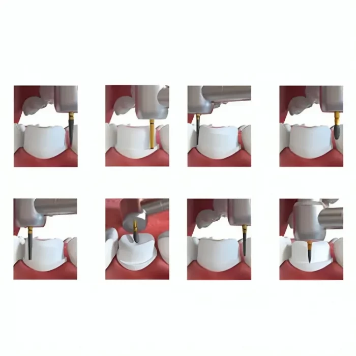 coltene_1_1 coltene_1_1