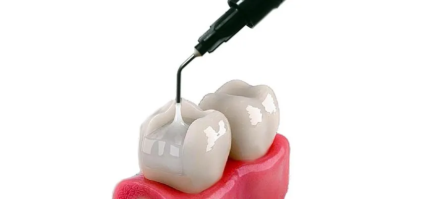 composite-ventura-bulkfill-flow-ii-35_4 composite-ventura-bulkfill-flow-ii-35_4