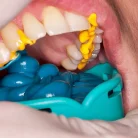 csm_honigumpro_putty_1_07f9c226fe_2_1