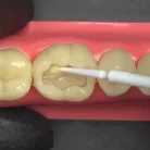 ivoclar-tetric-n-bond-universal-6gm-1000x1000_11zon_1__1_1