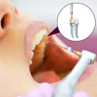 rotary-endodontic-blog_2