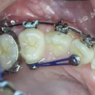 11_img_9824_1_m_after