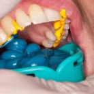 csm_honigumpro_putty_1_07f9c226fe