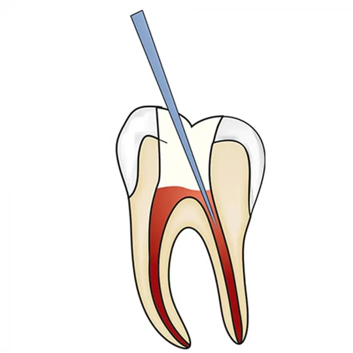 dg16-1