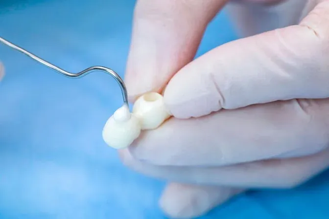 glass-ionomer-cement-luting_11zon glass-ionomer-cement-luting_11zon