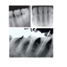 gomax-dgt-10-dental-x-ray-machine-1000x1000 (1)