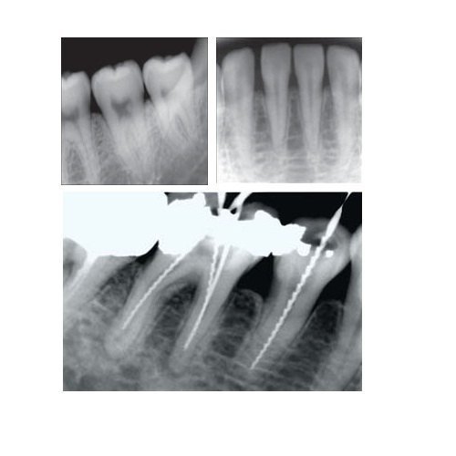 gomax-dgt-10-dental-x-ray-machine-1000x1000 (1) gomax-dgt-10-dental-x-ray-machine-1000x1000 (1)