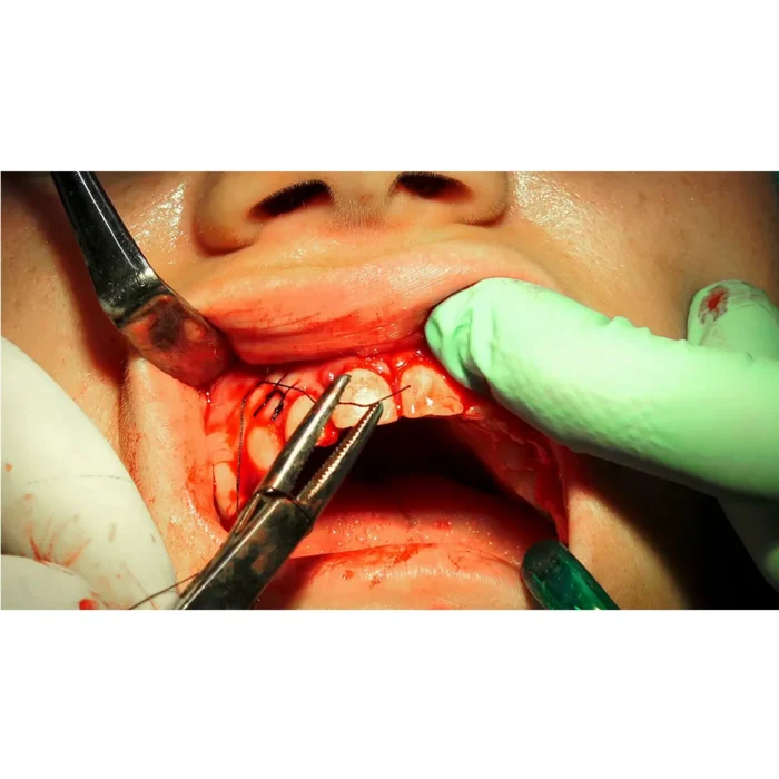 needle_holder2_1_3 needle_holder2_1_3