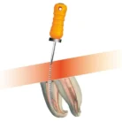 neoendo-neoprobe-files