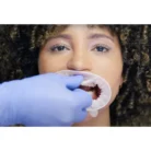 optragate1