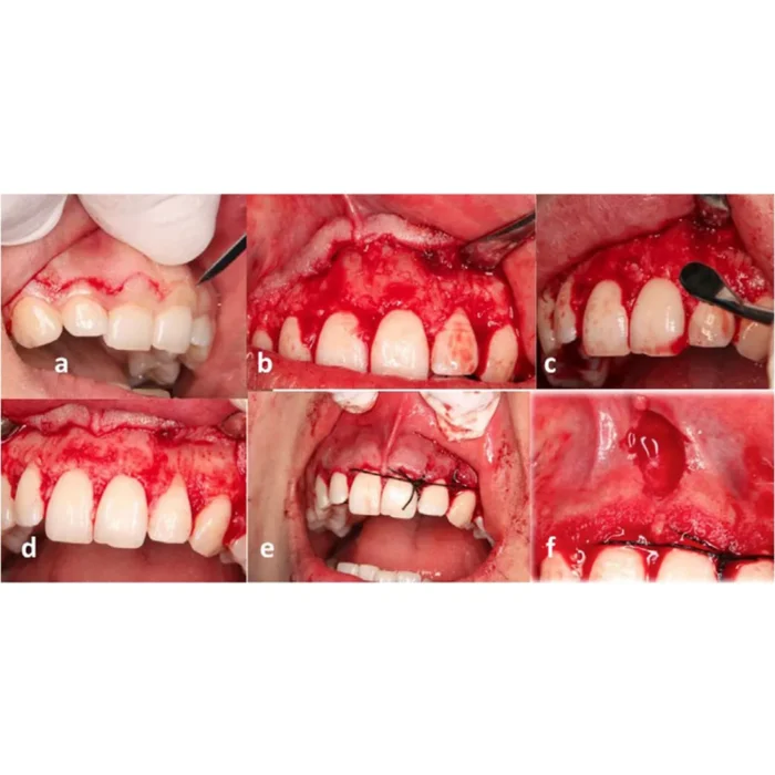 oral_surgery_1