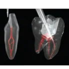 ss-white-endoguide-burs-5