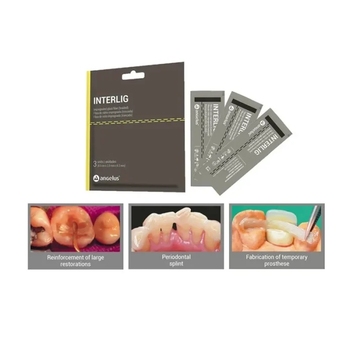 szyna-z-wlokna-szklanego-interlig-angelus-3-x-85cm-