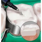 venus-bulk-fill-1-image-640w-360h_1