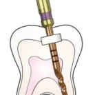 x-file-with-teeth-shape